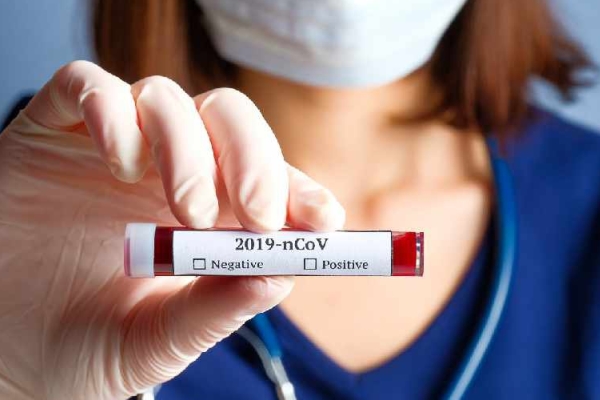 В ОАЭ за минувшие сутки выявлено 747 новых случаев заражения коронавирусом