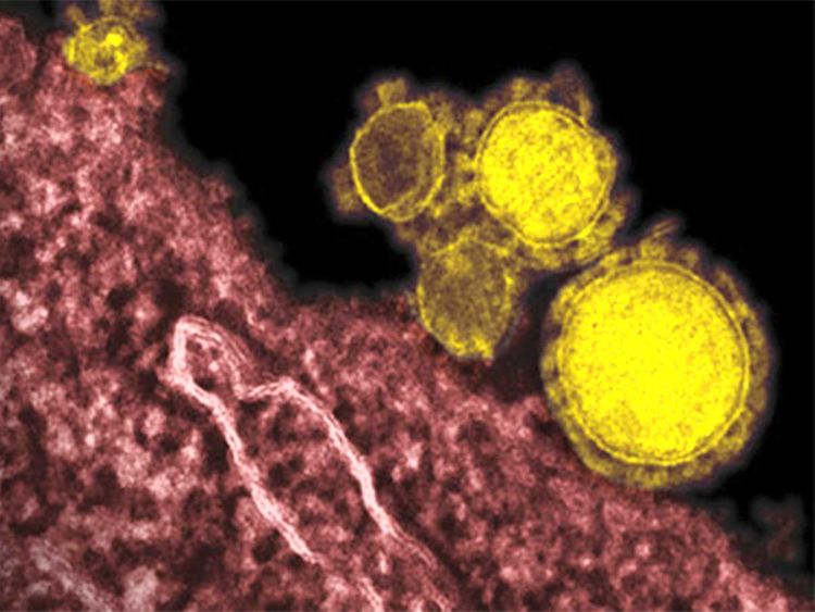 Первый случай инфекции коронавируса подтвержден в ОАЭ