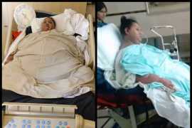 Former world’s heaviest woman Eman Abd El Aty dies in Abu Dhabi